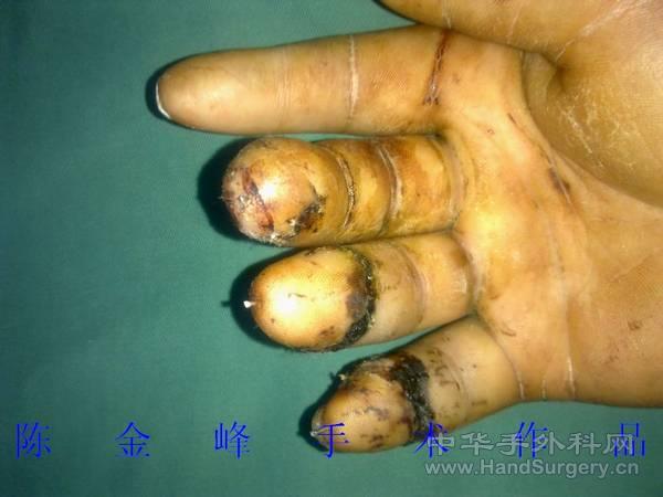 nEO_IMG_20110516181.jpg