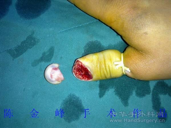 nEO_IMG_20110506157.jpg