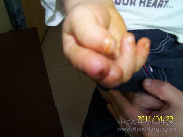 100_3695.JPG
