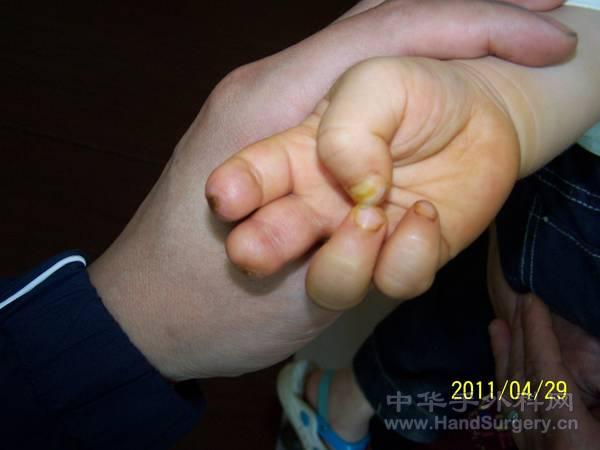 100_3698.JPG