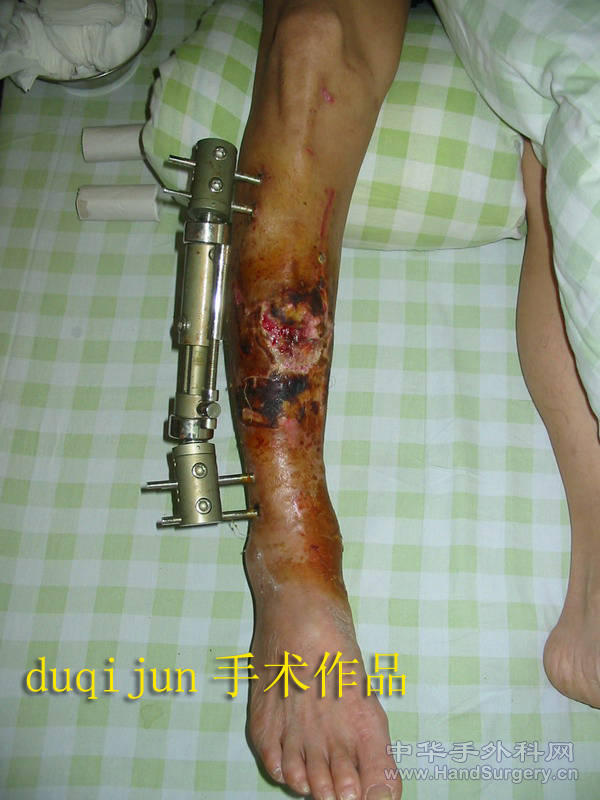 转入我科室时的情况