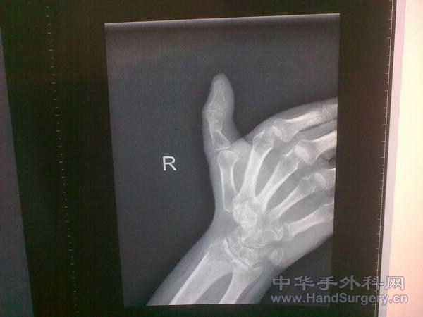 20110527052.jpg