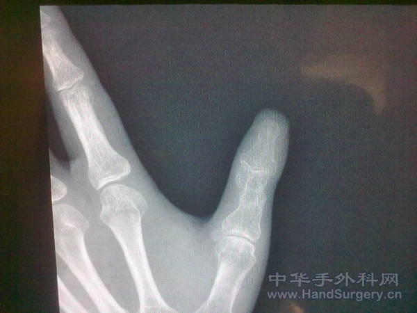 20110527054.jpg