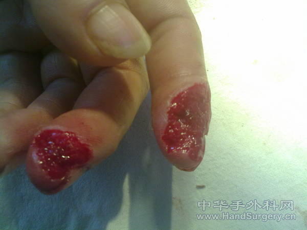 201105141123.jpg
