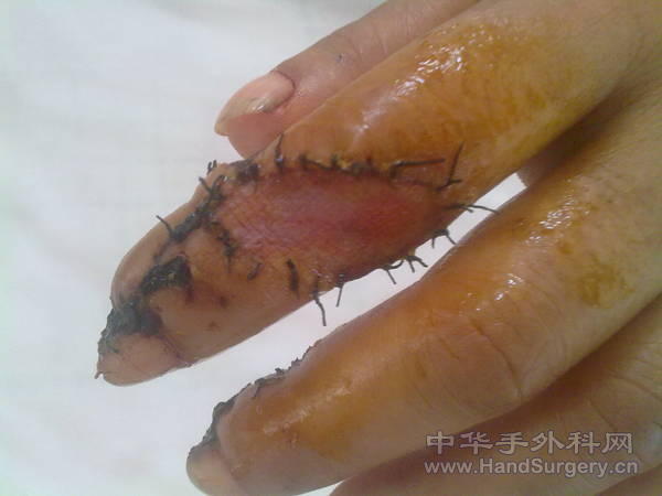 201105231150.jpg