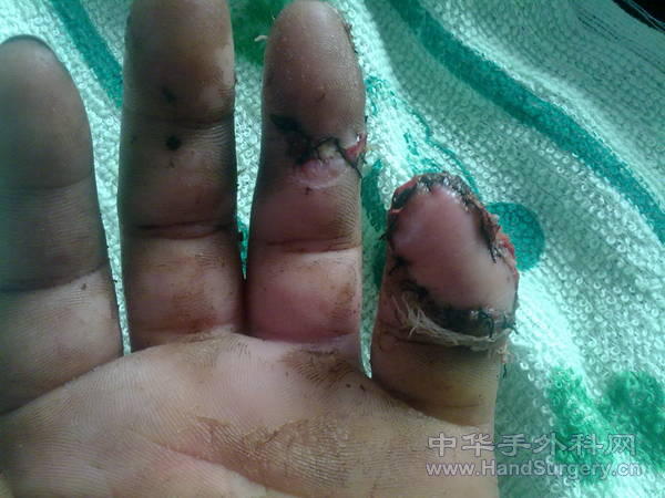 201105041089.jpg