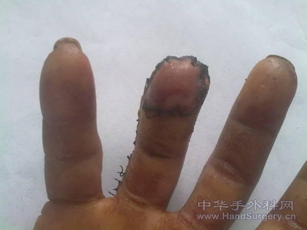 201105041092.jpg
