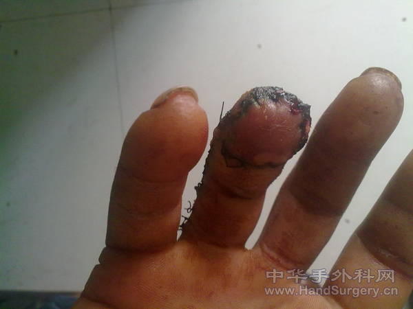 201105041096.jpg