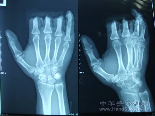 照片 313.jpg