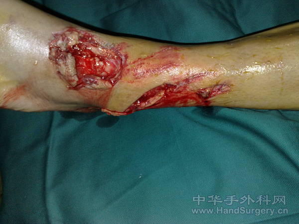 20110513995.jpg
