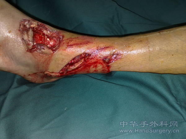 20110513996.jpg