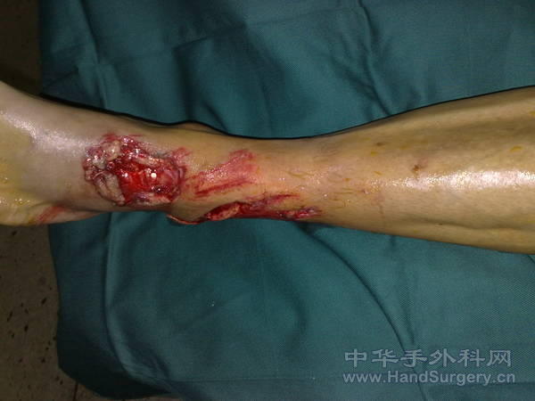 20110513997.jpg
