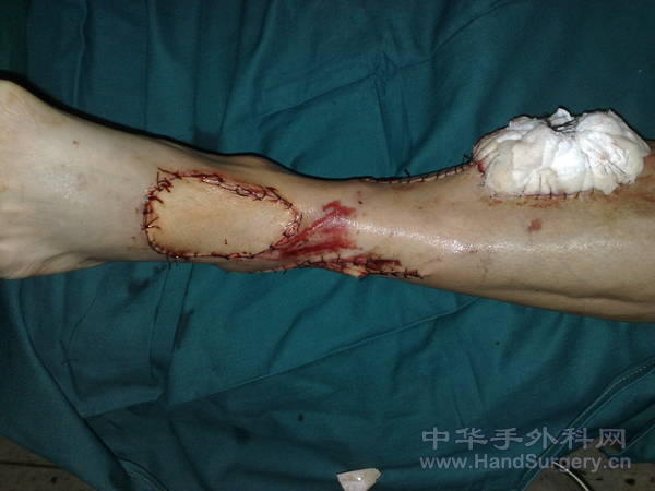 20110514999.jpg