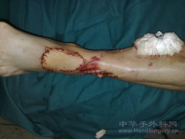 201105141000.jpg