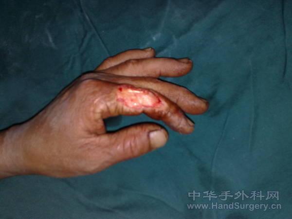 20110508974.jpg