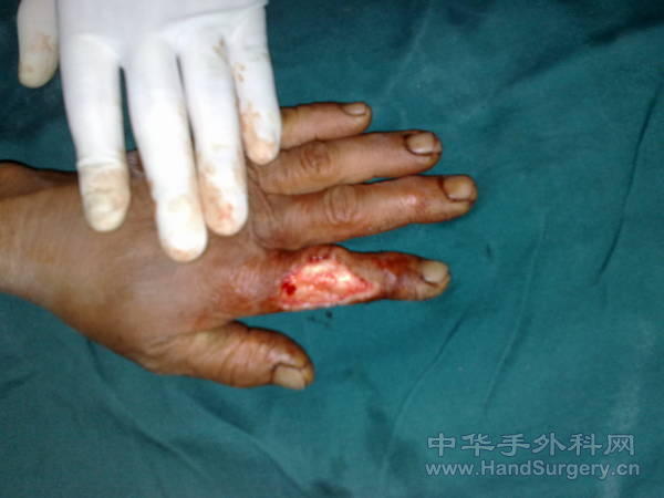 20110508975.jpg