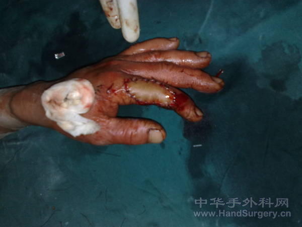 20110508976.jpg
