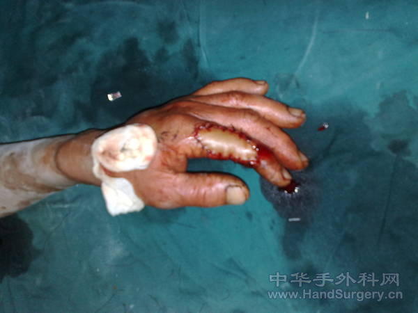 20110508978.jpg