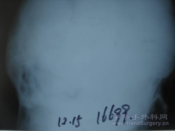 DSC00392.JPG