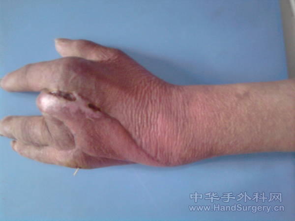 后期复查照片