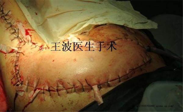 http_imgloadCA159J1O.jpg