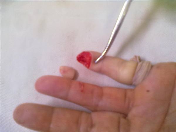 http_imgload[17].jpg