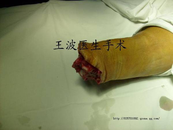http_imgload.jpg