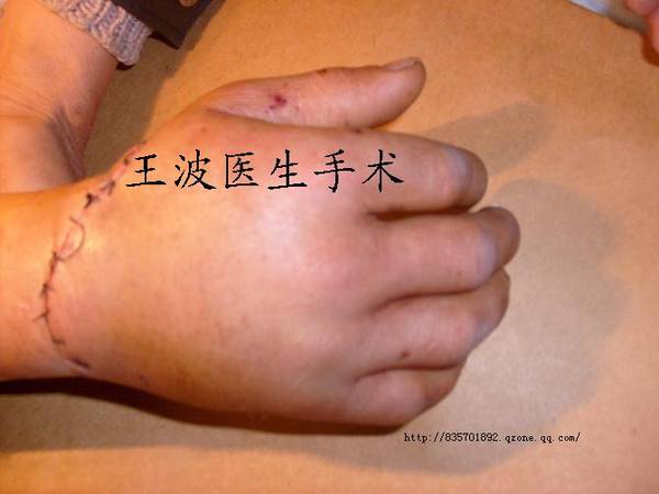 http_imgload6.jpg
