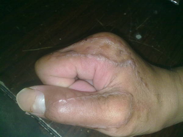 201106141160.jpg