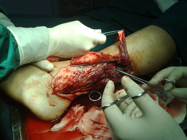 20110510986.jpg