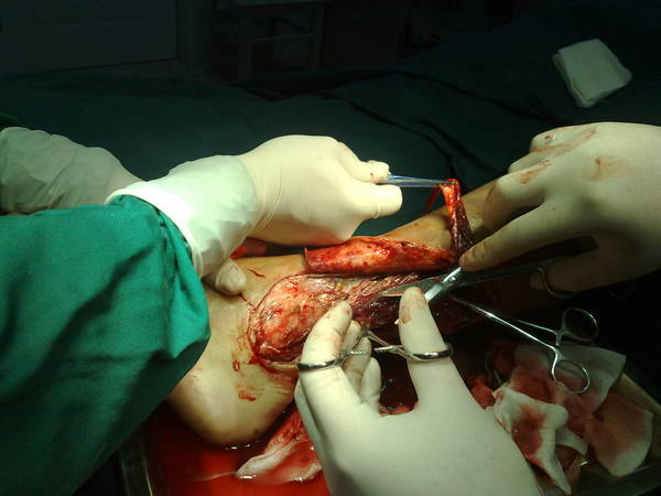 20110510987.jpg