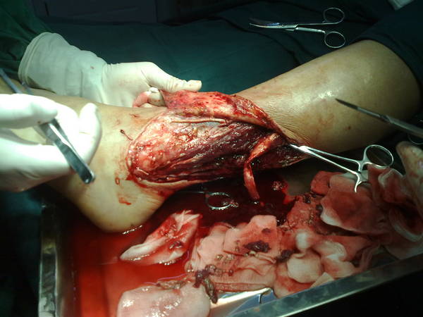 20110510989.jpg
