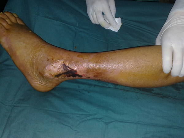 201106071106.jpg