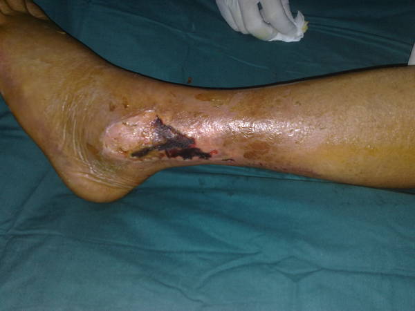 201106071107.jpg