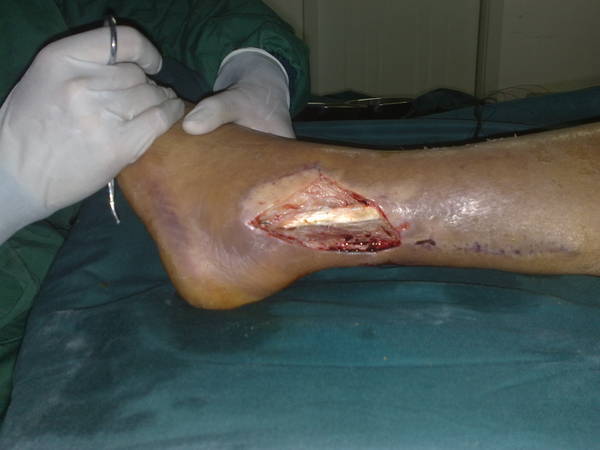 201106071111.jpg