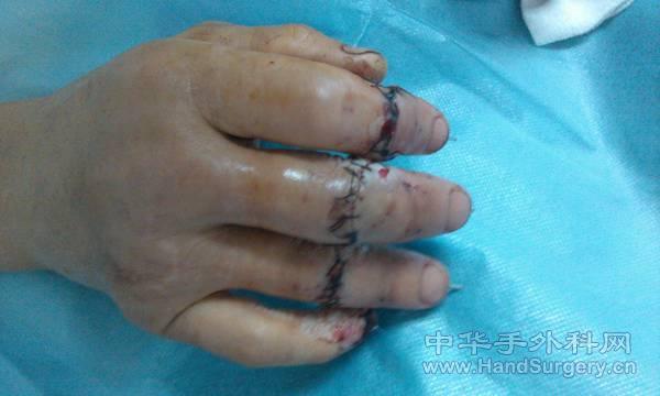 IMG_20110604_162659.jpg