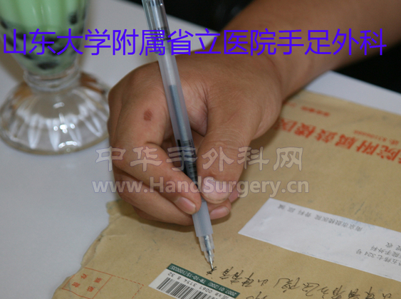 图4  字写的与术前一样美观和快速。副本.jpg