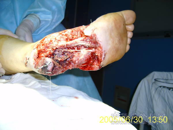 S5300171.JPG
