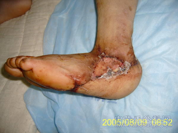 S5300286.JPG