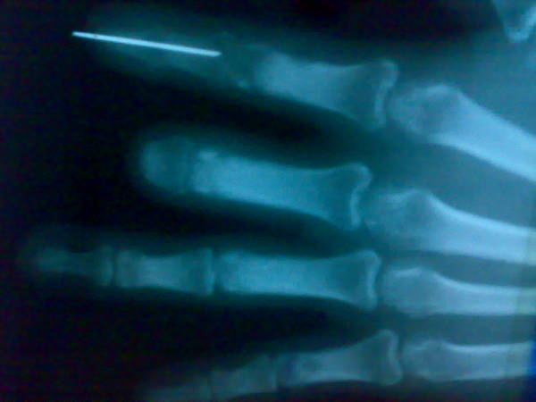 201106202079.jpg