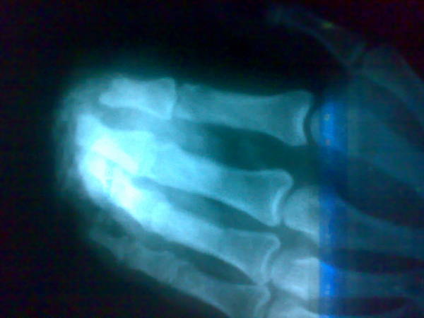 201106202080.jpg