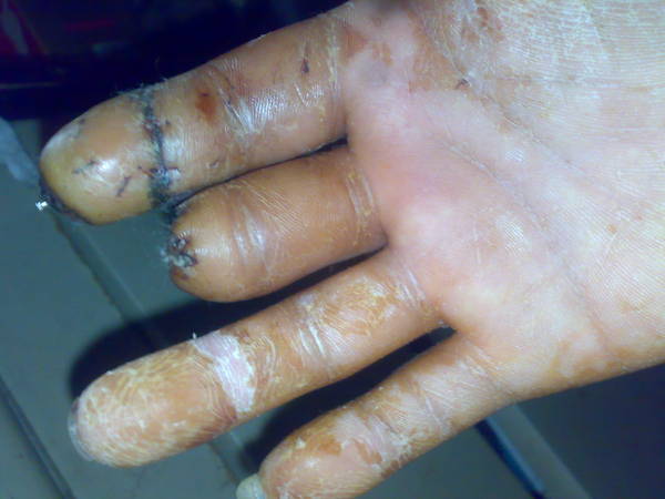 201103041930.jpg
