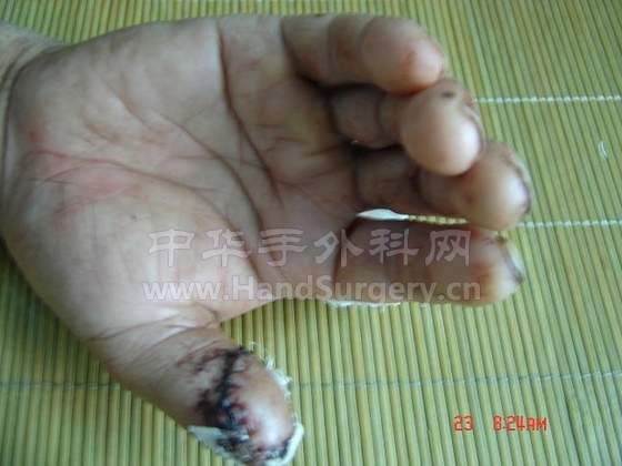 手外图片 056.JPG