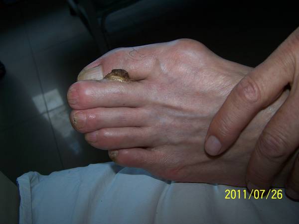 100_4501.JPG