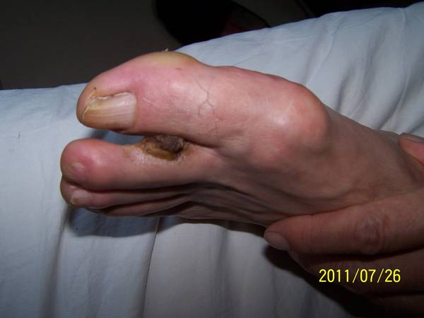 100_4504.JPG
