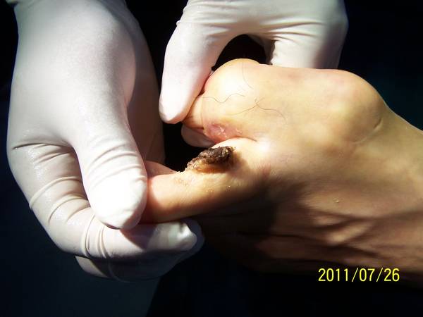100_4505.JPG