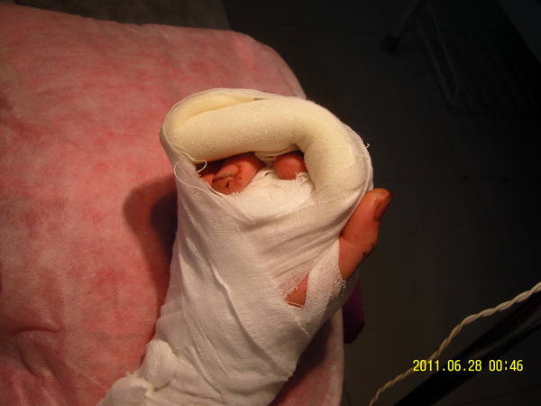 术后回病房1.jpg