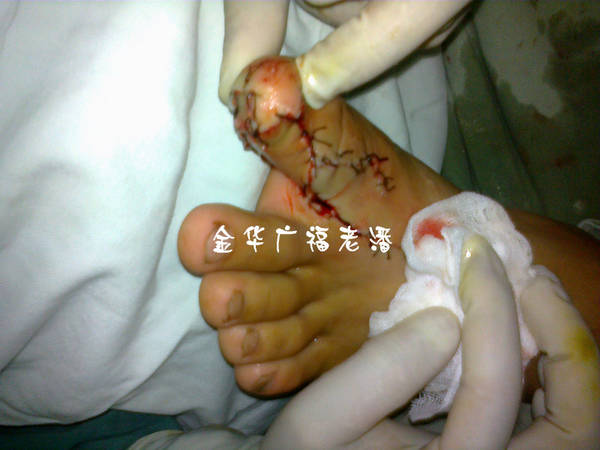 供区