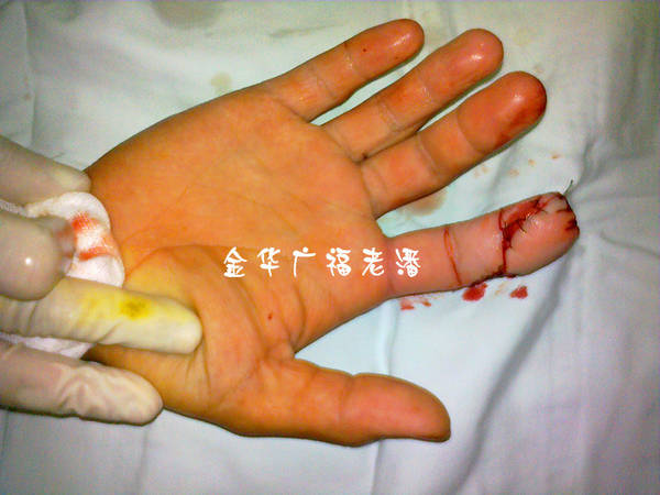 正面