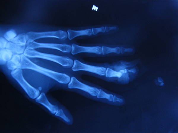 DSCF1315.JPG